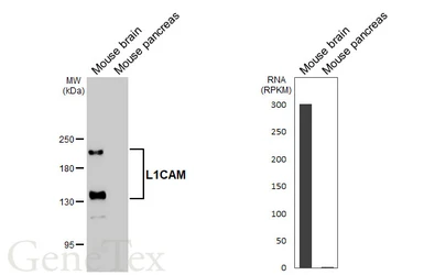 Anti-L1CAM antibody used in Western Blot (WB). GTX129010