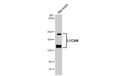 Anti-L1CAM antibody used in Western Blot (WB). GTX129010