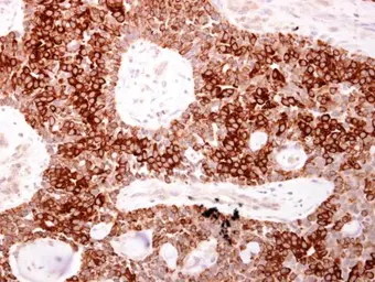 Anti-AHR antibody used in IHC (Paraffin sections) (IHC-P). GTX129012