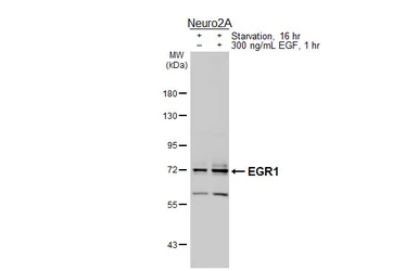 Anti-EGR1 antibody used in Western Blot (WB). GTX129015