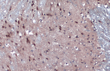 Anti-JARID2 antibody used in IHC (Paraffin sections) (IHC-P). GTX129019