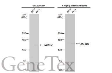 Anti-JARID2 antibody used in Western Blot (WB). GTX129019