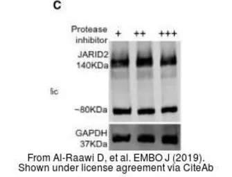 Anti-JARID2 antibody used in Western Blot (WB). GTX129020
