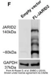 Anti-JARID2 antibody used in Western Blot (WB). GTX129020