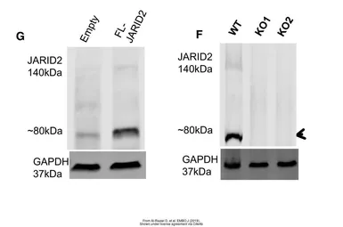 Anti-JARID2 antibody used in Western Blot (WB). GTX129020
