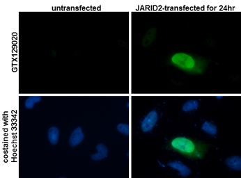 Anti-JARID2 antibody used in Immunocytochemistry/ Immunofluorescence (ICC/IF). GTX129020