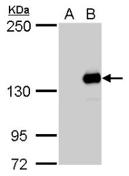 Anti-JARID2 antibody used in Western Blot (WB). GTX129020