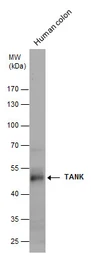 Anti-TANK antibody used in Western Blot (WB). GTX129037