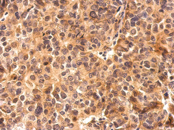 Anti-CARM1 antibody used in IHC (Paraffin sections) (IHC-P). GTX129040