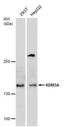 Anti-KDM3A antibody used in Western Blot (WB). GTX129046