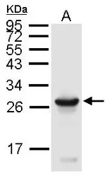 Anti-Uchl3 antibody used in Western Blot (WB). GTX129067