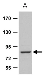 Anti-Zranb1b antibody used in Western Blot (WB). GTX129068