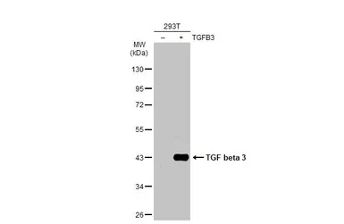 Anti-TGF beta 3 antibody used in Western Blot (WB). GTX129091