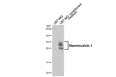 Anti-Stanniocalcin 1 antibody used in Western Blot (WB). GTX129092