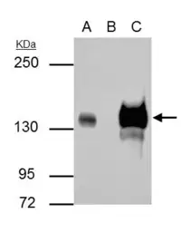Anti-Rubicon antibody used in Immunoprecipitation (IP). GTX129096