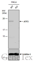 Anti-ATF3 antibody used in Western Blot (WB). GTX129120