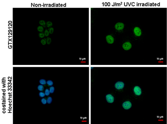 Anti-ATF3 antibody used in Immunocytochemistry/ Immunofluorescence (ICC/IF). GTX129120