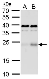Anti-ATF3 antibody used in Western Blot (WB). GTX129120