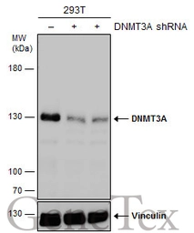 Anti-DNMT3A antibody used in Western Blot (WB). GTX129126