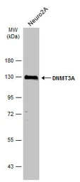 Anti-DNMT3A antibody used in Western Blot (WB). GTX129126