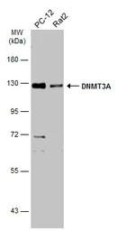 Anti-DNMT3A antibody used in Western Blot (WB). GTX129126