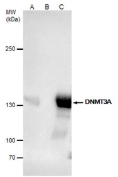 Anti-DNMT3A antibody used in Immunoprecipitation (IP). GTX129126