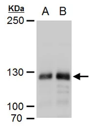 Anti-DNMT3A antibody used in Western Blot (WB). GTX129126
