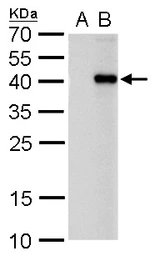 Anti-PITX2 antibody used in Western Blot (WB). GTX129141