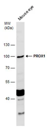 Anti-PROX1 antibody used in Western Blot (WB). GTX129143