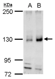 Anti-REST antibody used in Western Blot (WB). GTX129144