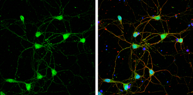 Anti-GLUT3 antibody used in Immunocytochemistry/ Immunofluorescence (ICC/IF). GTX129175