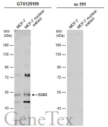 Anti-EGR3 antibody used in Western Blot (WB). GTX129199