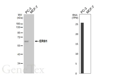 Anti-ER81 antibody used in Western Blot (WB). GTX129202