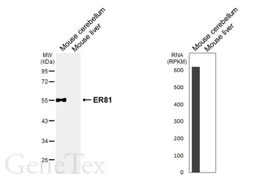 Anti-ER81 antibody used in Western Blot (WB). GTX129202