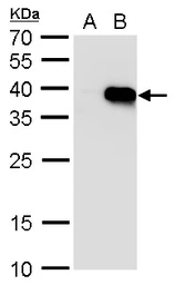 Anti-HOXA5 antibody used in Western Blot (WB). GTX129211