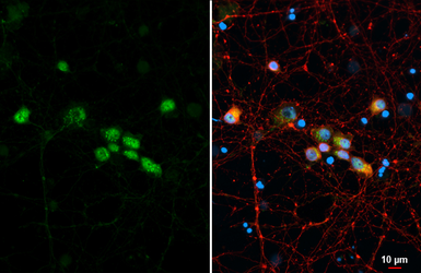 Anti-LIM1 antibody used in Immunocytochemistry/ Immunofluorescence (ICC/IF). GTX129215