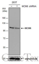 Anti-MCM6 antibody used in Western Blot (WB). GTX129216