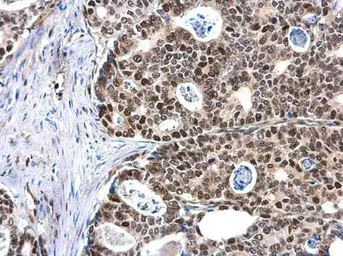 Anti-MCM6 antibody used in IHC (Paraffin sections) (IHC-P). GTX129218