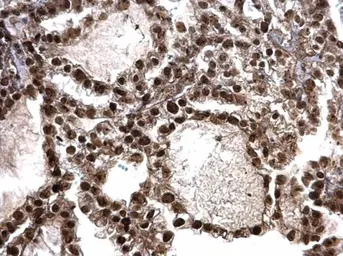 Anti-MCM6 antibody used in IHC (Paraffin sections) (IHC-P). GTX129218