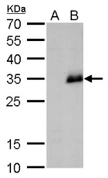 Anti-Neurogenin 1 antibody used in Western Blot (WB). GTX129223