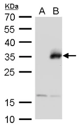 Anti-Neurogenin 1 antibody used in Western Blot (WB). GTX129224
