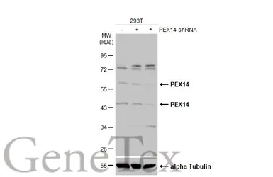 Anti-PEX14 antibody used in Western Blot (WB). GTX129230