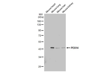 Anti-PEX14 antibody used in Western Blot (WB). GTX129230