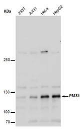 Anti-PMS1 antibody used in Western Blot (WB). GTX129232