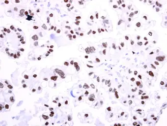 Anti-HNF1 beta antibody used in IHC (Paraffin sections) (IHC-P). GTX129236
