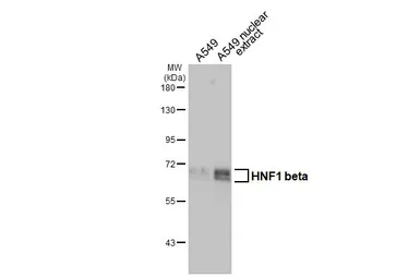 Anti-HNF1 beta antibody used in Western Blot (WB). GTX129236