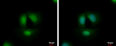 Anti-TCF3 / E2A antibody used in Immunocytochemistry/ Immunofluorescence (ICC/IF). GTX129237