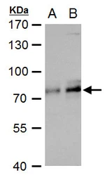 Anti-TCF3 / E2A antibody used in Western Blot (WB). GTX129237