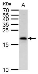 Anti-MAFK antibody used in Western Blot (WB). GTX129240