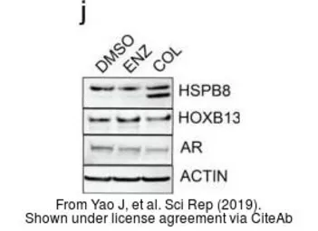 Anti-HOXB13 antibody used in Western Blot (WB). GTX129245